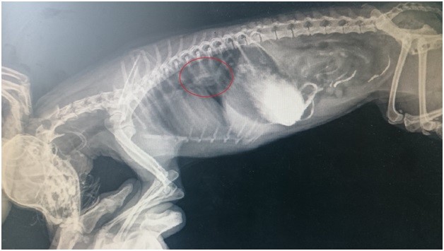 Рис 7.Рентгенограмма с барием. Инородное тело в дистальной части грудного отдела пищевода. Частичная непроходимость