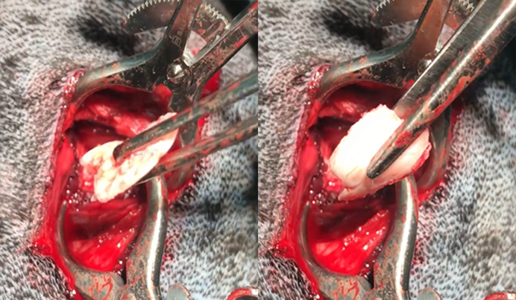 Отслоившийся хрящ 1-1