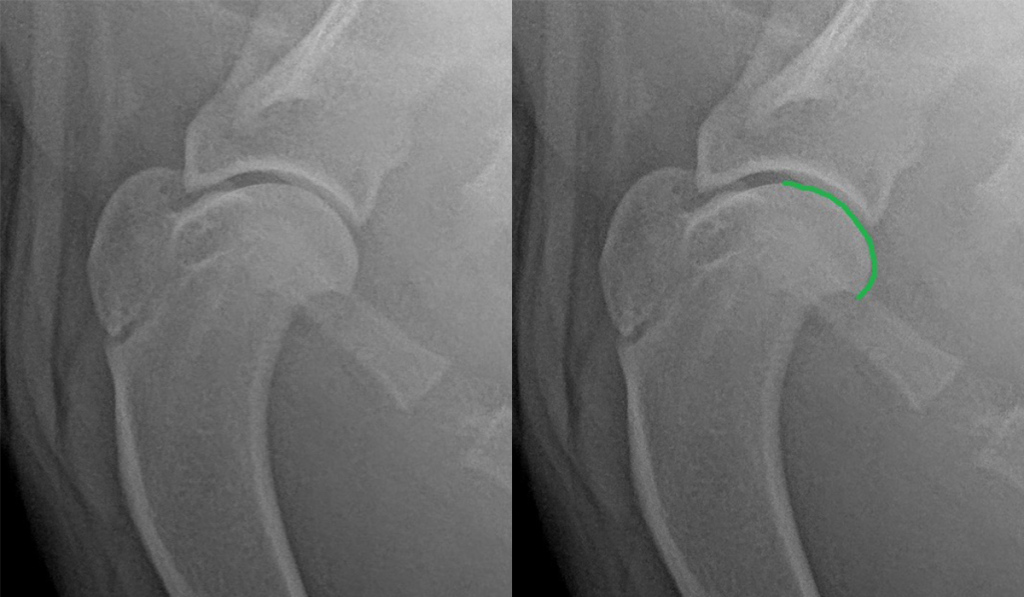 Поверхность головки в отметкой