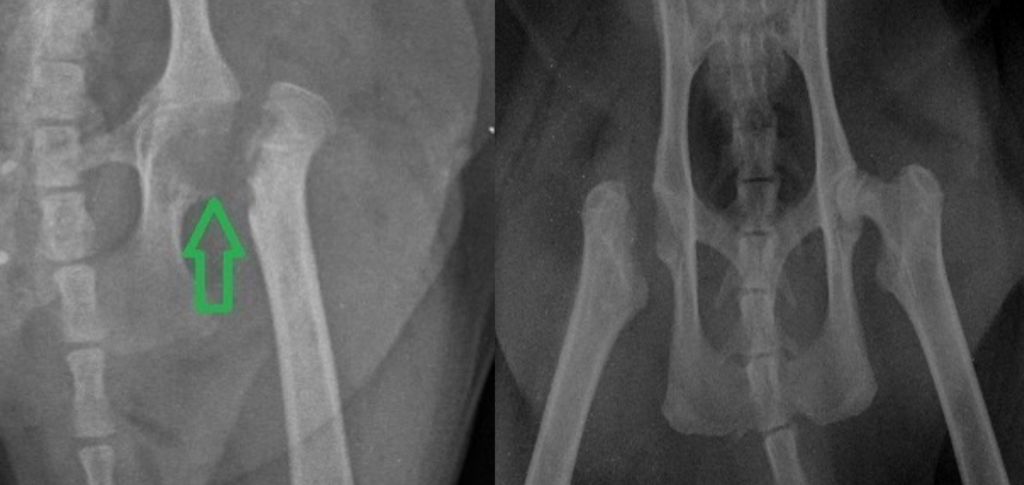 Болезнь Пертеса-10