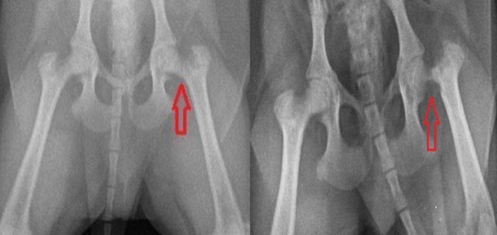 Болезнь Пертеса-5