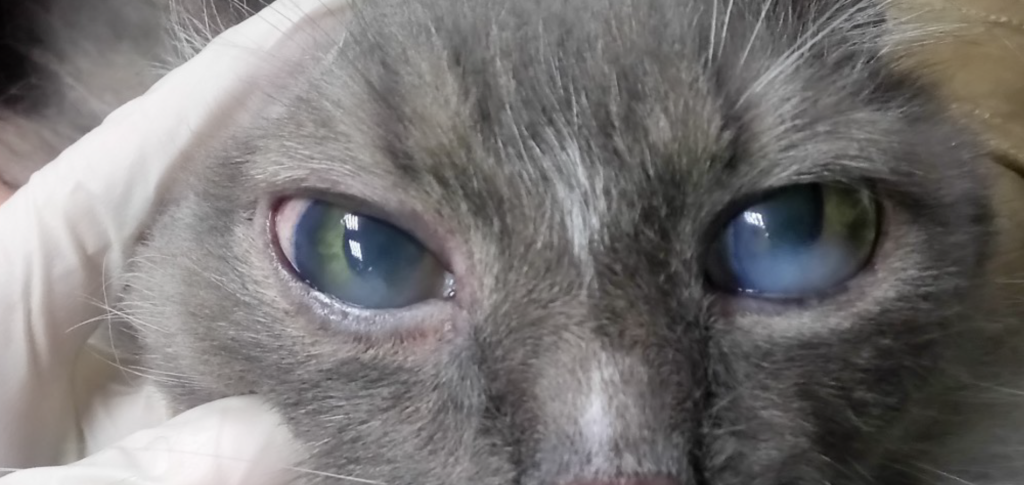 Отложение жирового вещества в роговице