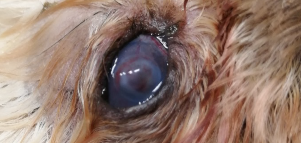 Вторичное поражение глаза (заживление обширной язвы) при менингоэнцефалите