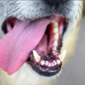 Зубной камень