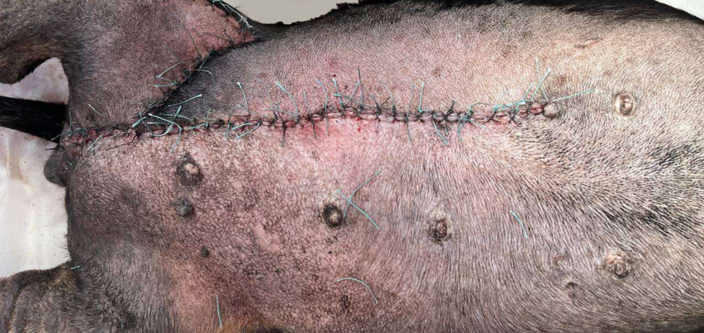 карцинома молочной железы-2