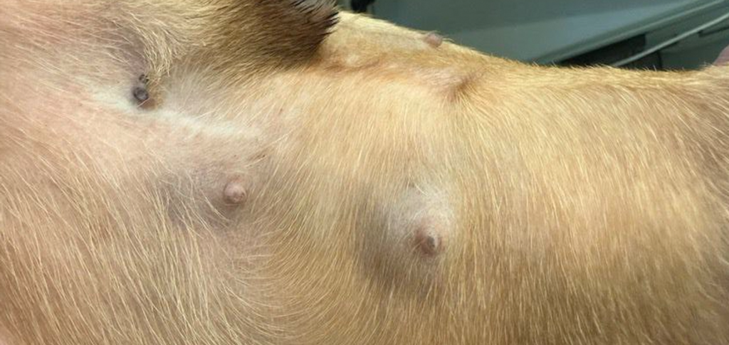 карцинома молочной железы-3