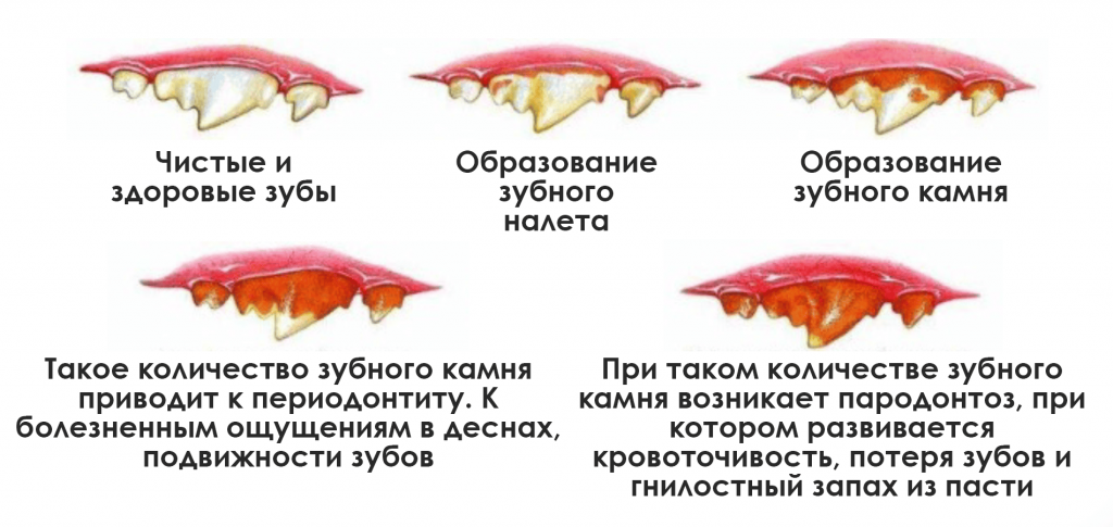 Пародонтит-2