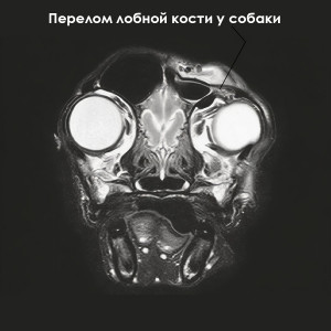 ЧМТ - 2