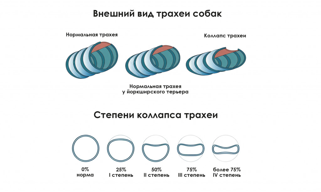 Степени коллапса